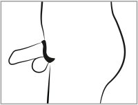Aperçu: Penis Käfig mit Dilator