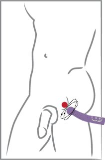 Prostate Twister pour traire la prostate Prostate Twister pour traire la prostate